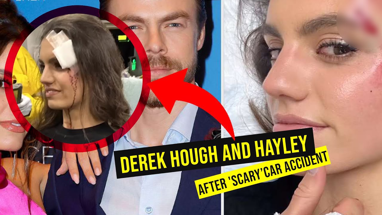 Derek Hough and Hayley Erbert survive scary car accident