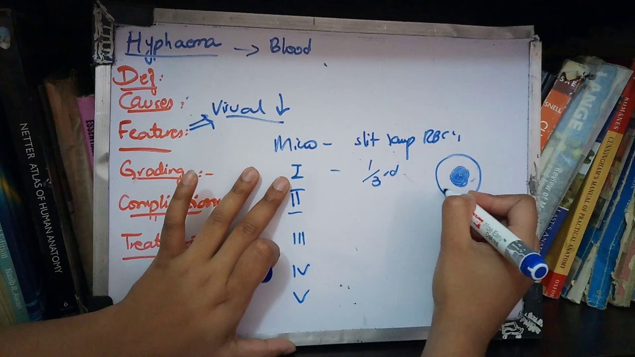 HYPHAEMA very important concept made simple