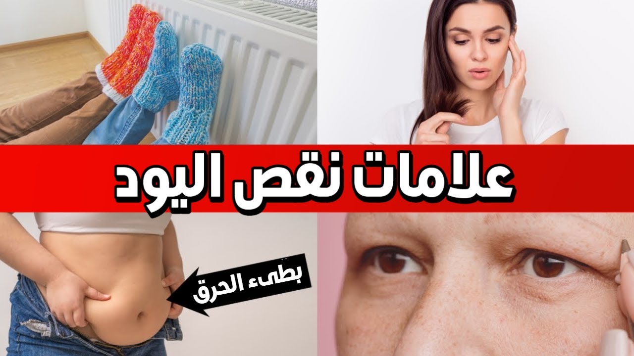 سبع علامات تخبرك أن اليود منخفض في جسمك وفي أي طعام يوجد لتعويض النقص