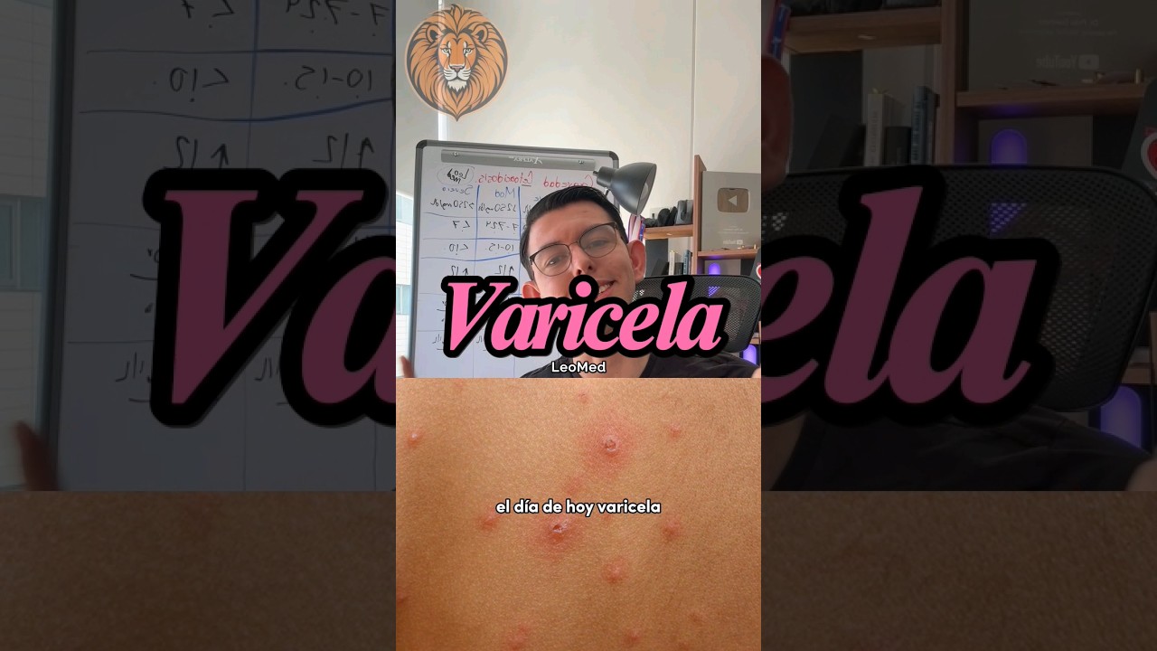 &iquest;Ya sabes diferenciar la varicela? 🤒🩸🤔 #medicina #educaci&oacute;n