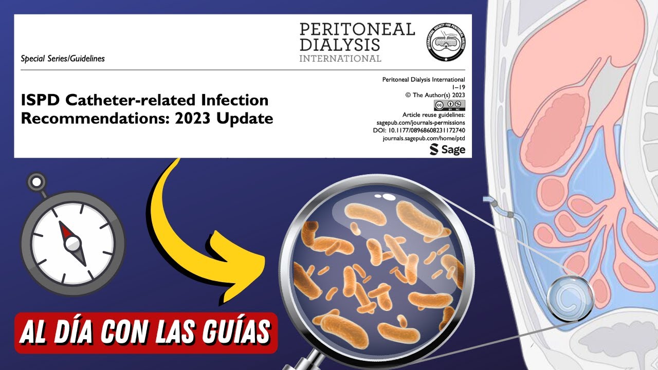 Infección Catéter de Diálisis Peritoneal #AlDíaConLasGuías