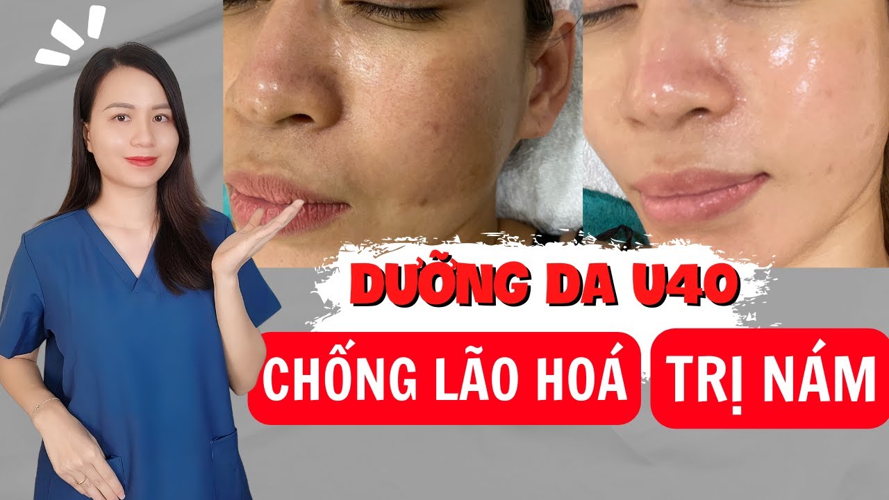 Tiết lộ BÍ QUYẾT chăm sóc da tuổi 40 - CHỐNG LÃO HOÁ & điều trị NÁM tàn nhang với 4 bước đơn giản