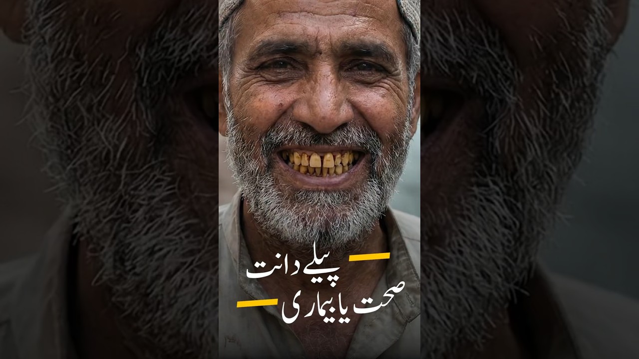 4 BIG Mistakes You're Making That Turn Your Teeth Yellow | Dr Aqeel Maqsood