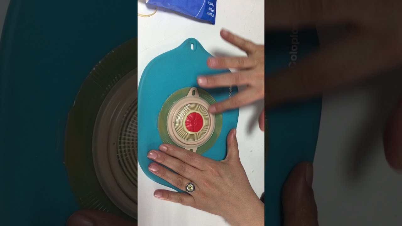 COLOPLAST KOLOSTOMİ TORBASI UYGULAMA AŞAMALARI