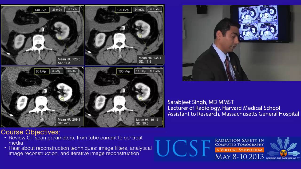 Glossary of CT Scan Parameters: What they mean and don't mean
