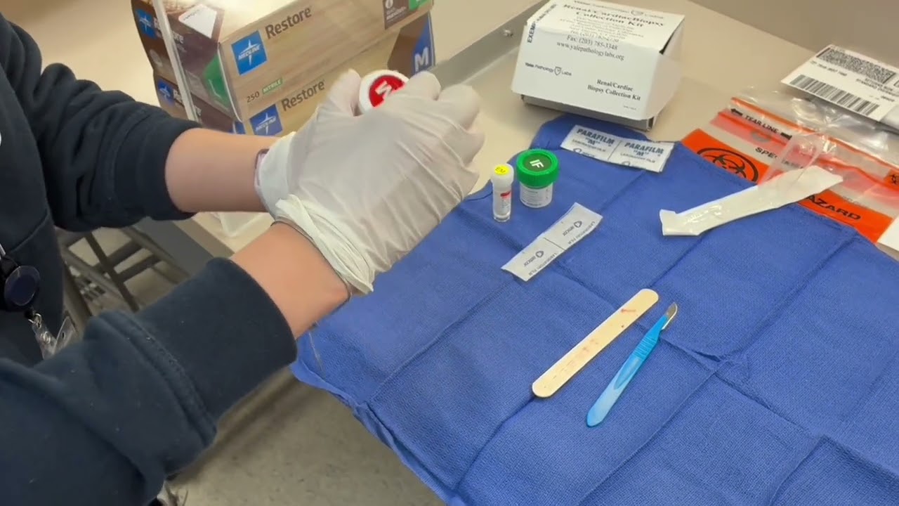 Cómo utilizar el kit de biopsia renal de Yale Pathology (en español)