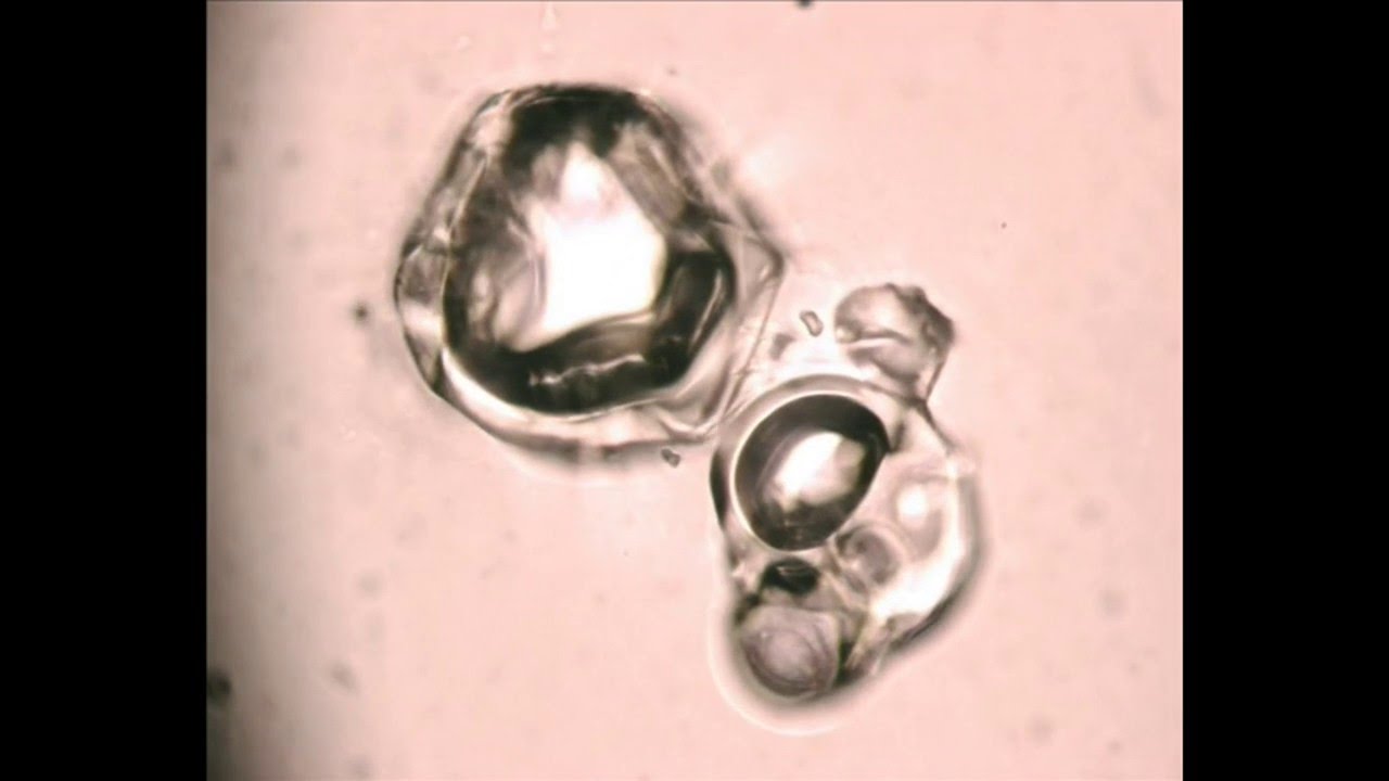 Early Development Screening for Technology Selection and Formulation Design