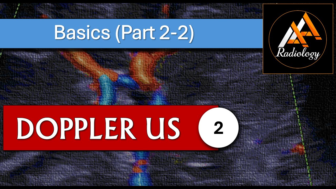 2 - Master Doppler image optimization, hemodynamics, RI, AT, waveform features, changes & analysis