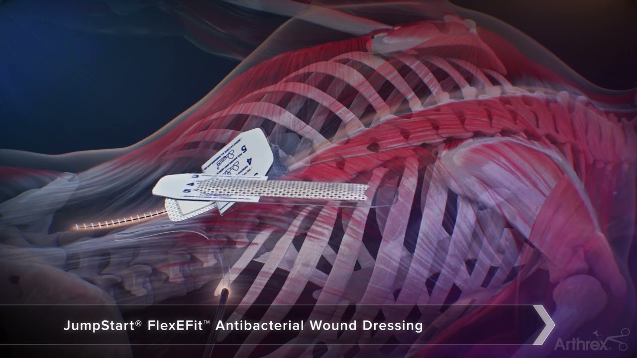JumpStart&reg; FlexEFit&trade; Antibacterial Wound Dressing