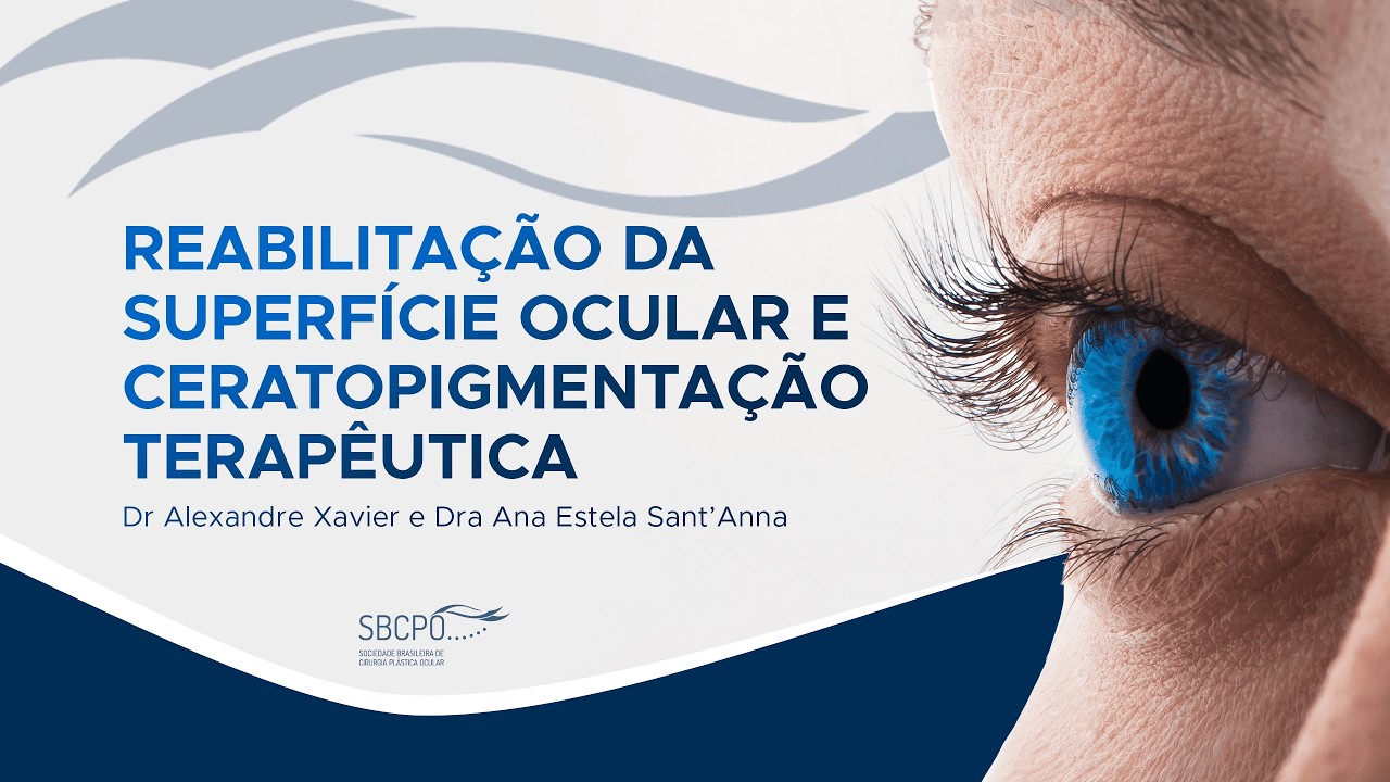 Ep 7: Reabilitação da superfície ocular e ceratopigmentação - Dr Alexandre Xavier e Dra Ana Estela