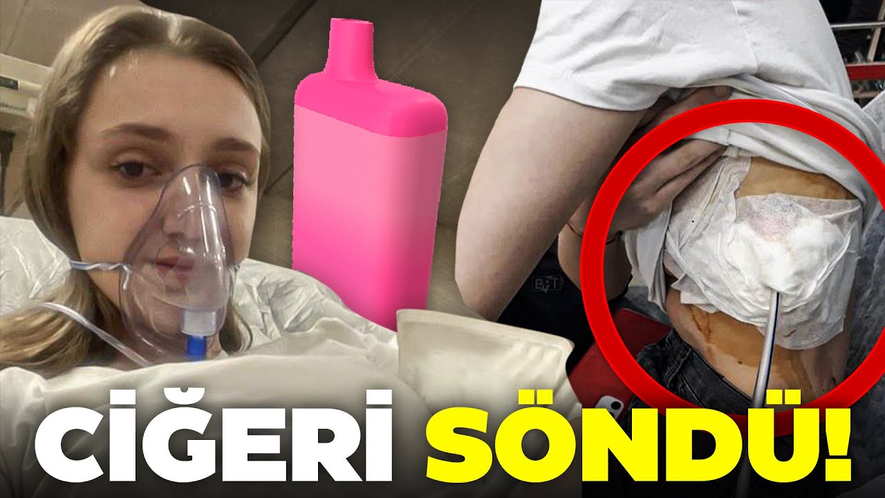 ELEKTRONİK SİGARA BATAKLIĞI