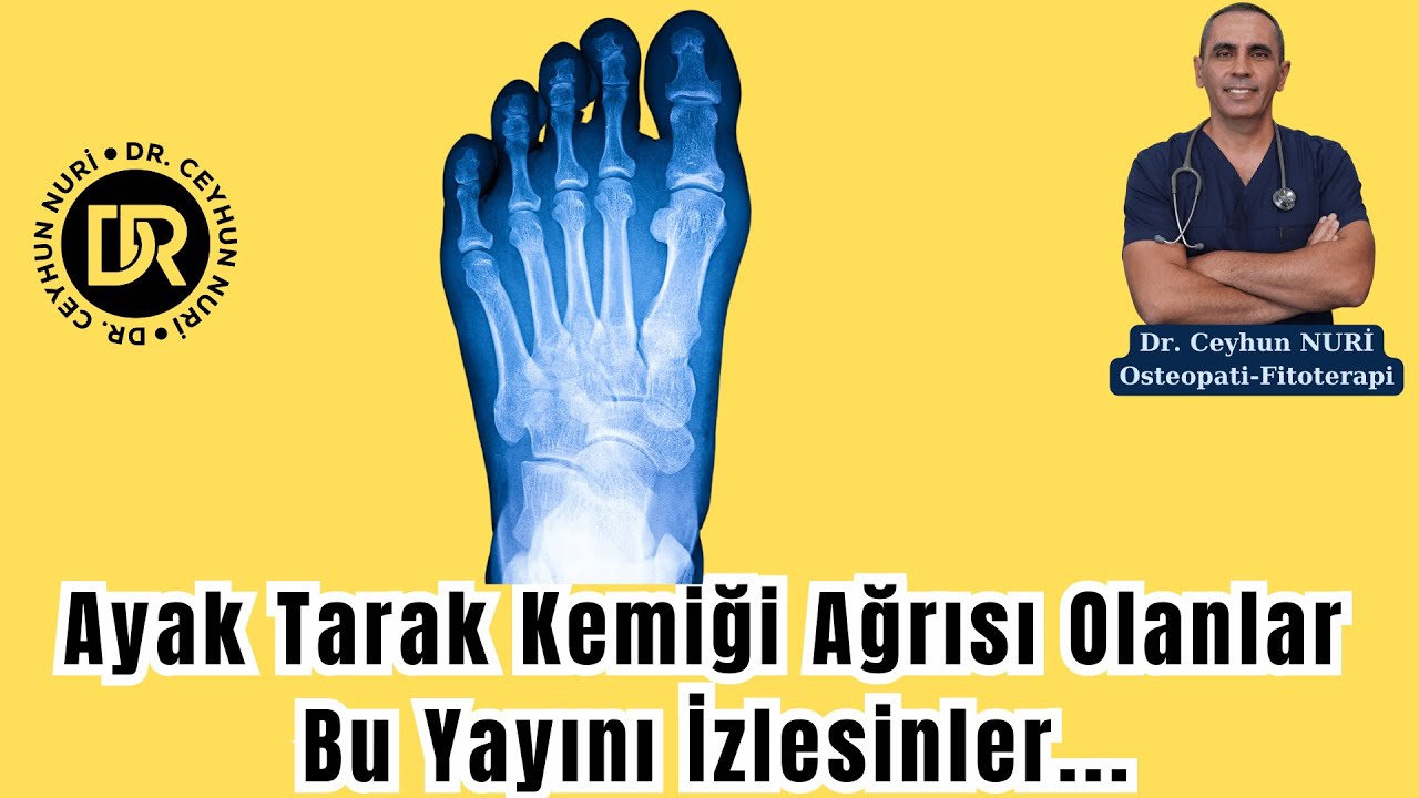 Ayak Tarak Kemiği Ağrısı Olanlar Bu Yayını İzleyiniz...#sağlık #ayak #ayaksağlığı #ayakağrısı #kemik