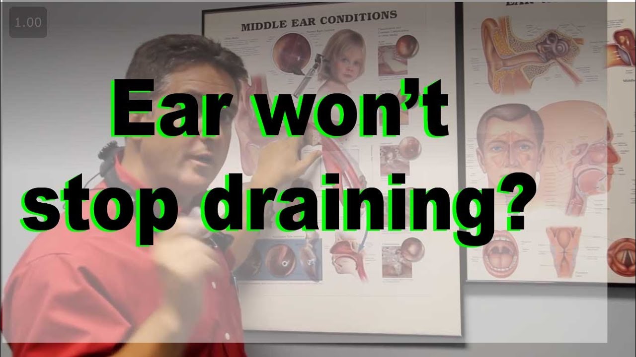 Chronic Draining Ear