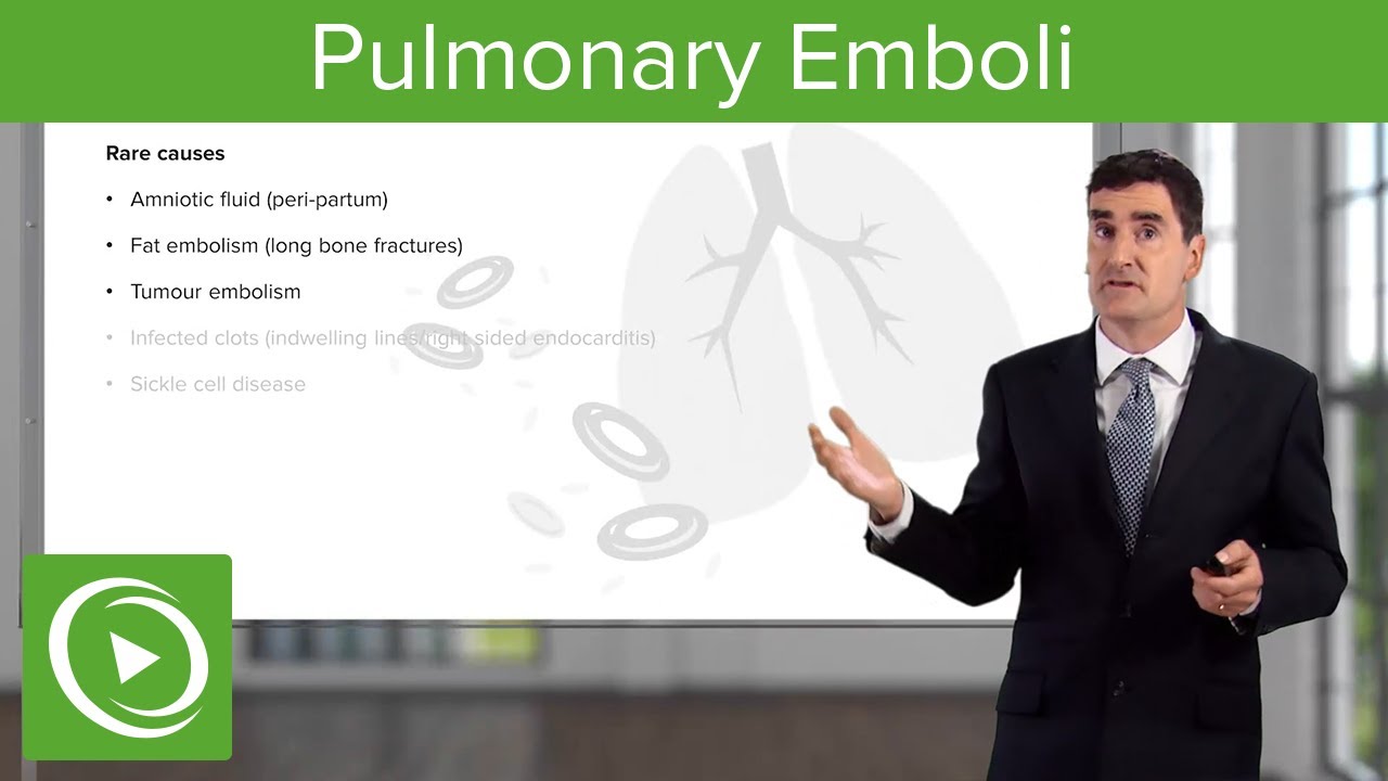 Pulmonary Emboli – Pulmonary Vascular Disease | Lecturio