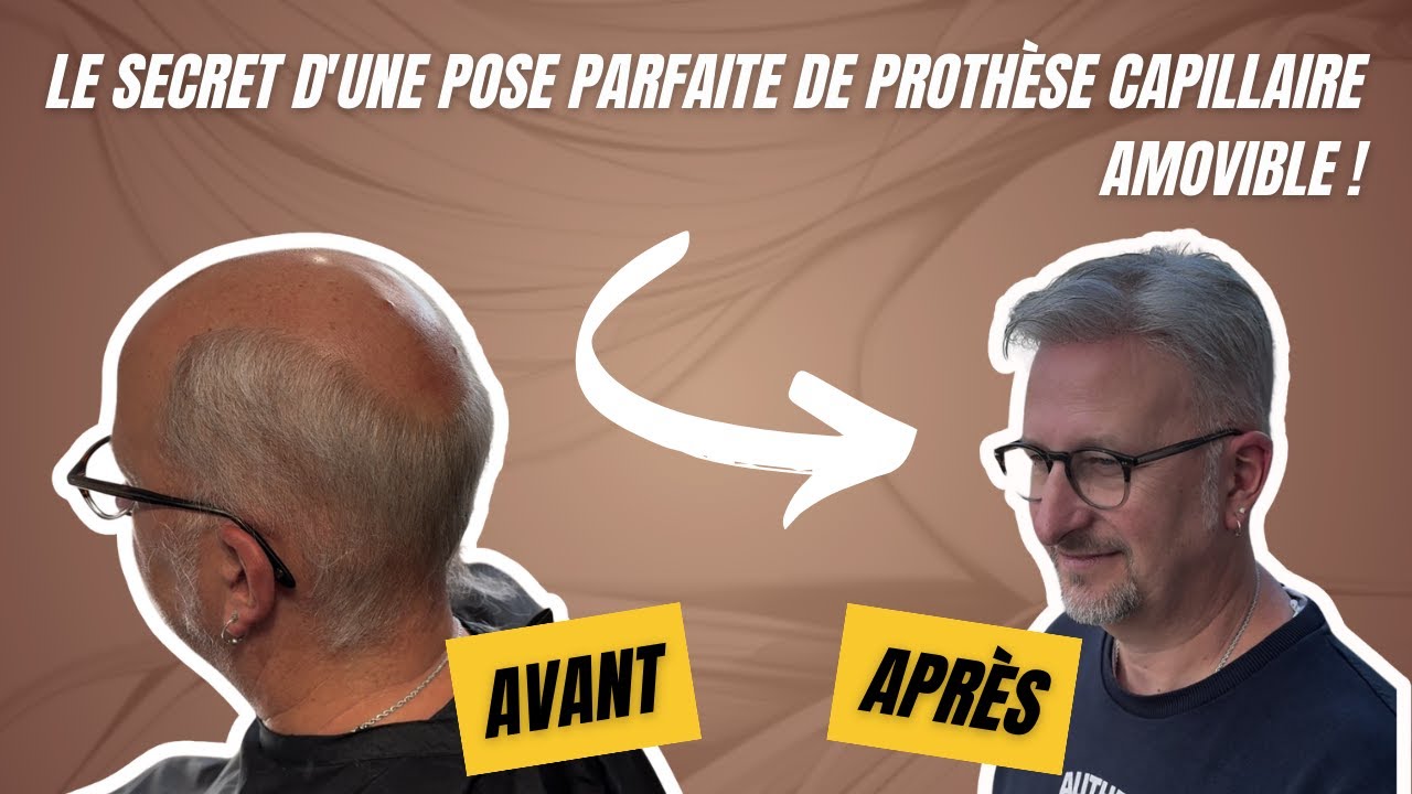 Comment poser une prothèse capillaire amovible : le tuto complet !