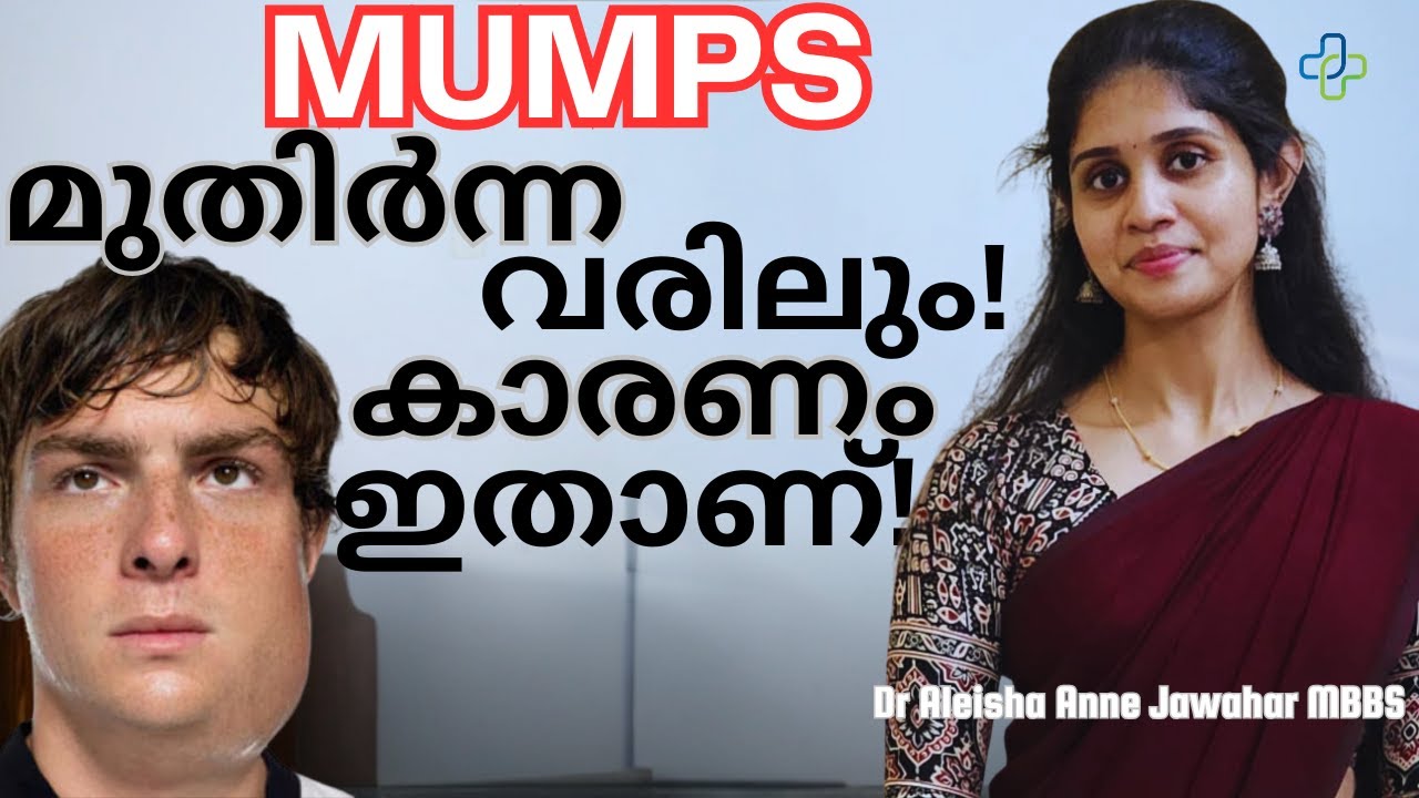 MUMPS |മുണ്ടിനീര് കേരളത്തിൽ പടരുന്നതിന് കാരണം |Malayalam|