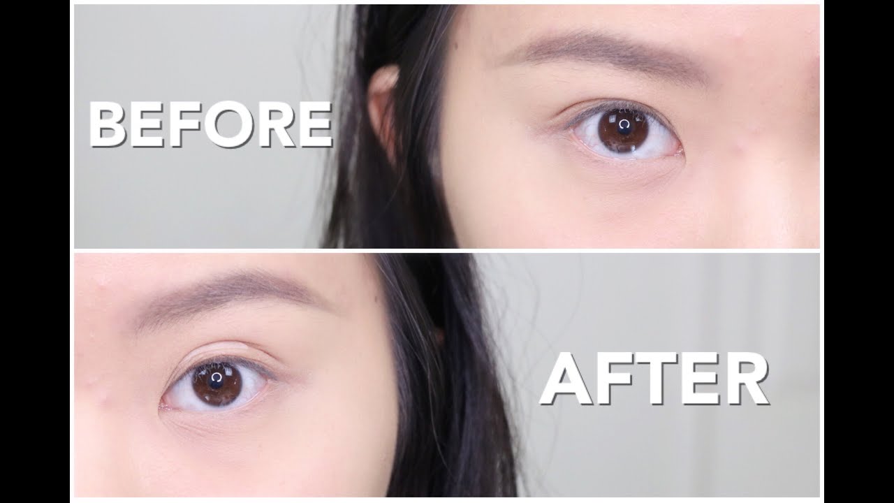 HOW TO: Even/Double Eyelids - Naturally | How I 