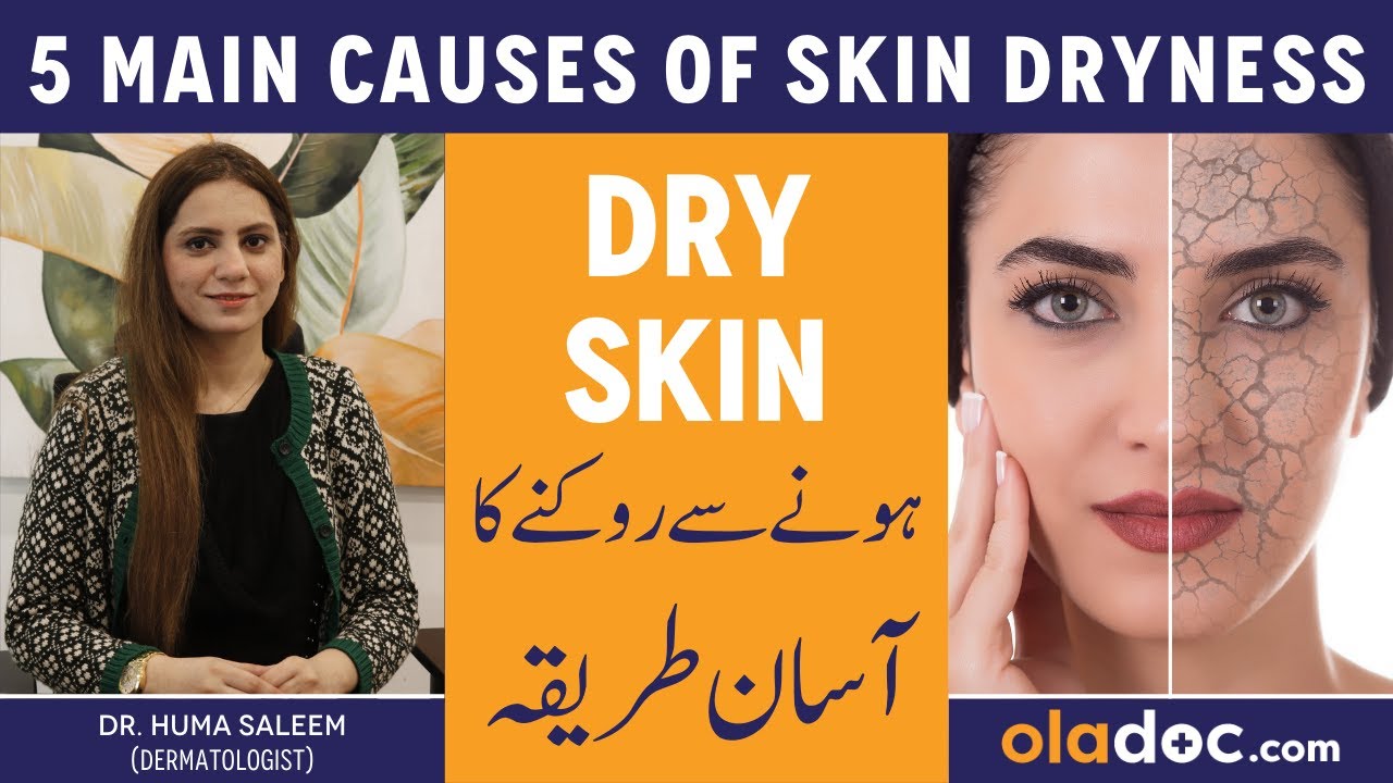 HOW TO PREVENT SKIN DRYNESS - Dry Skin Ka Asan Gharelu Ilaj - Home Remedies For Dry Skin In Urdu