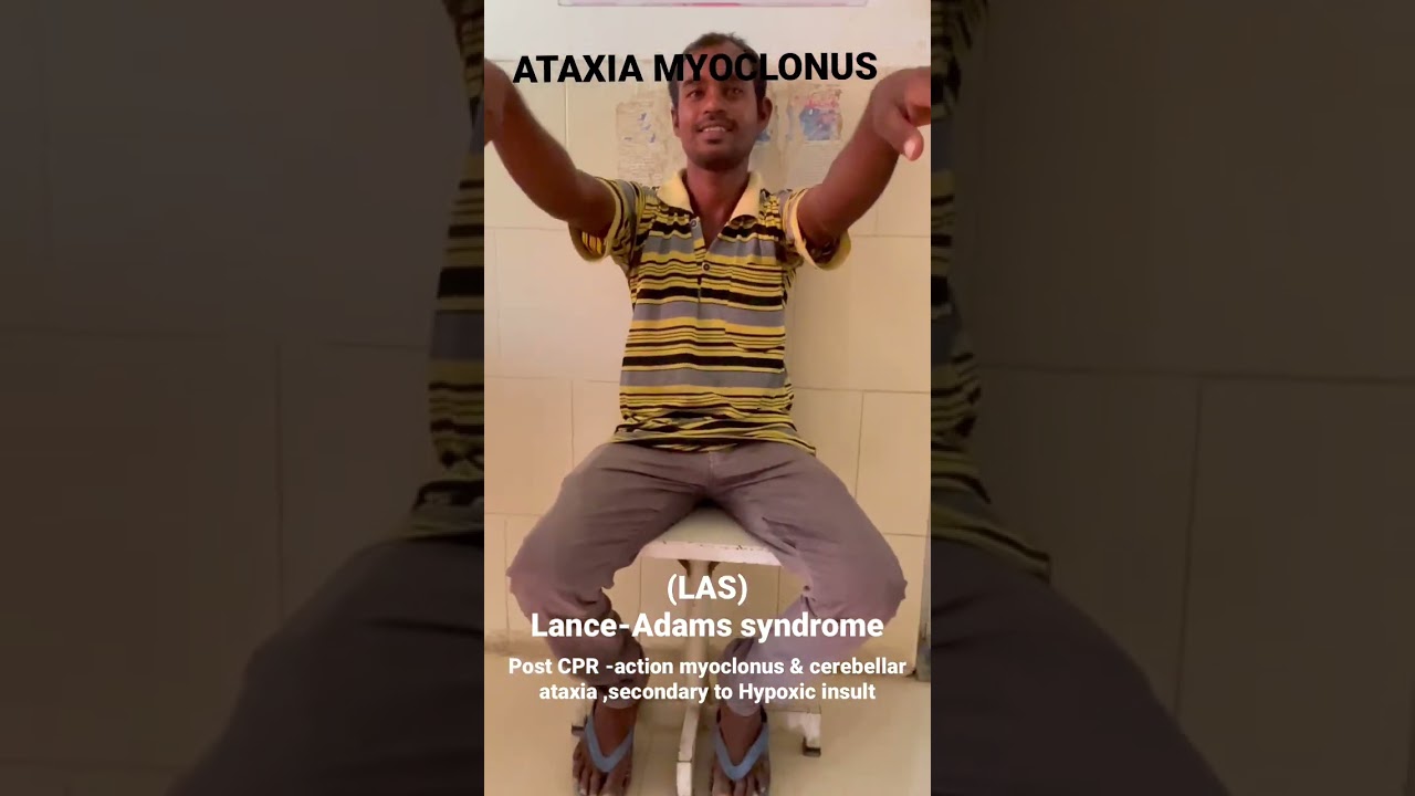 Ataxia myoclonus-Lance-Adams Syndrome #neetpg #clinical #neurology #shorts
