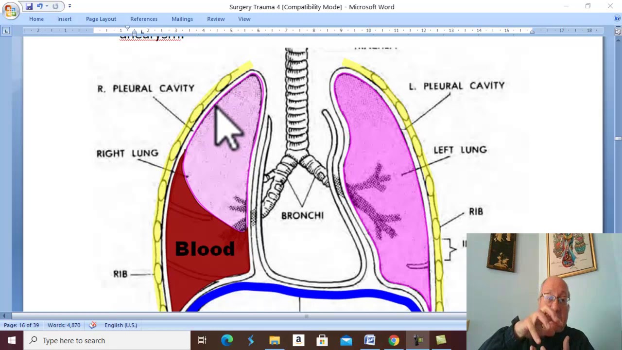 Trauma in Arabic 25 ( Haemothorax ) , by Dr. Wahdan .