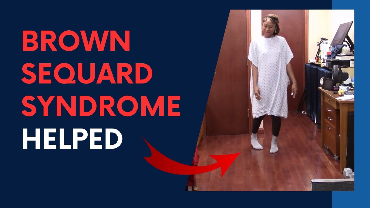 Brown Sequard Syndrome Treatment HELPED by Dr Suh