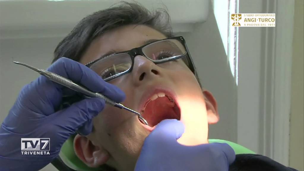 L'evoluzione del Sorriso - Adolescenti e apparecchio linguale (Studio Angi Turco)