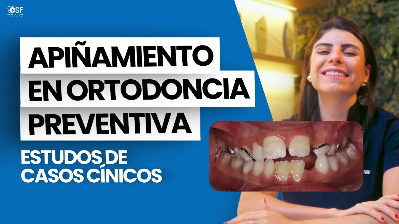CASOS CLÍNICOS DE APIÑAMIENTO EN ORTODONCIA PREVENTIVA