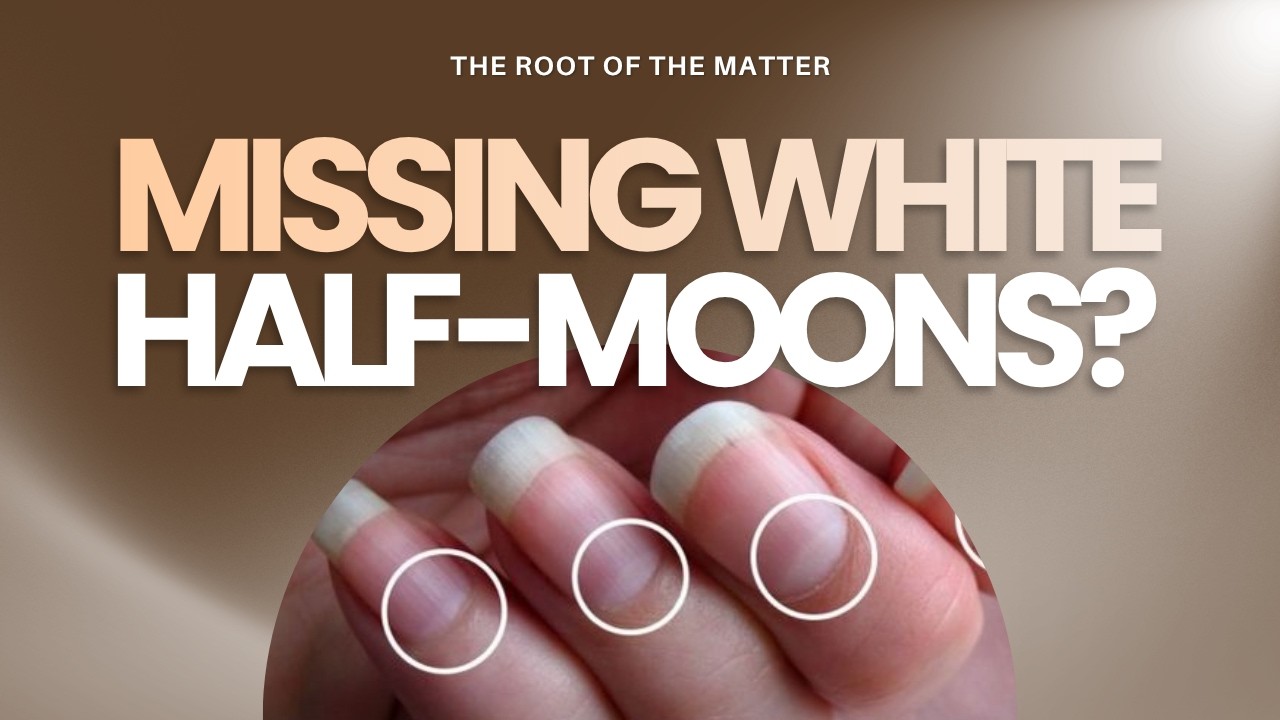 What Your Hands Are Trying to Tell You: Fingernail & Hand Diagnosis for Gut, Liver, and Hormones