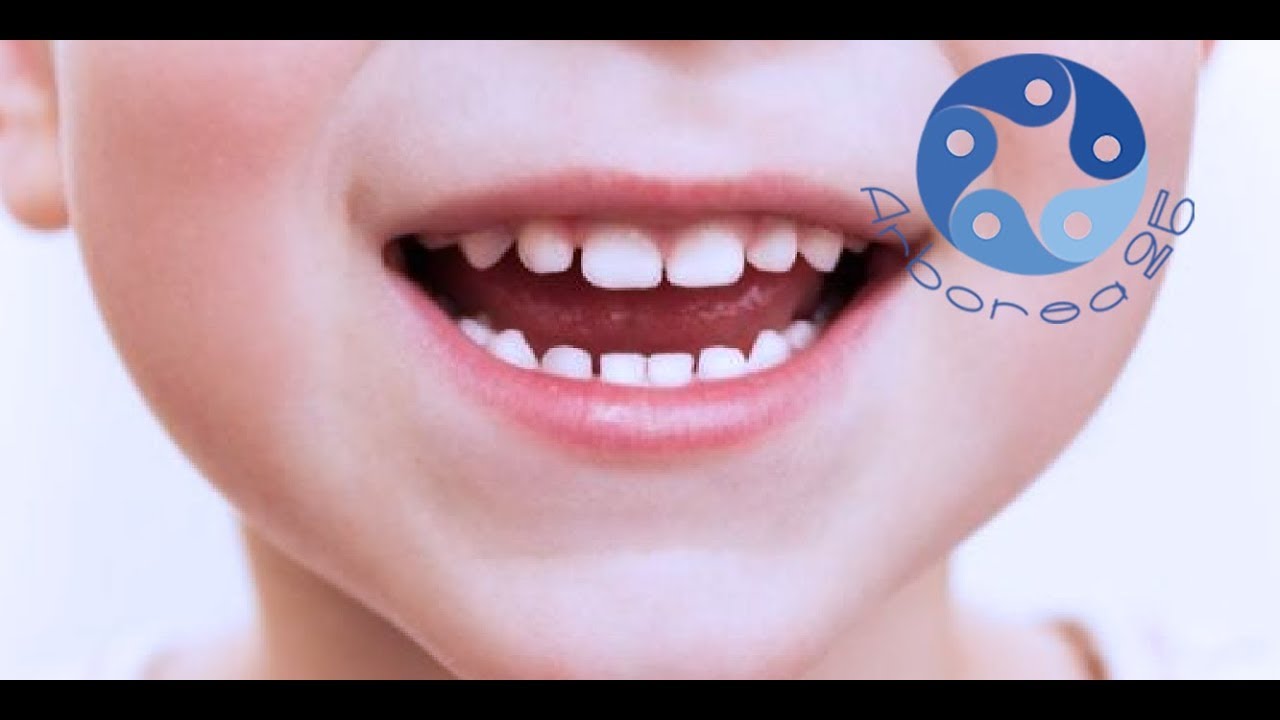 La lingua e il suo ruolo nella posizione dei denti