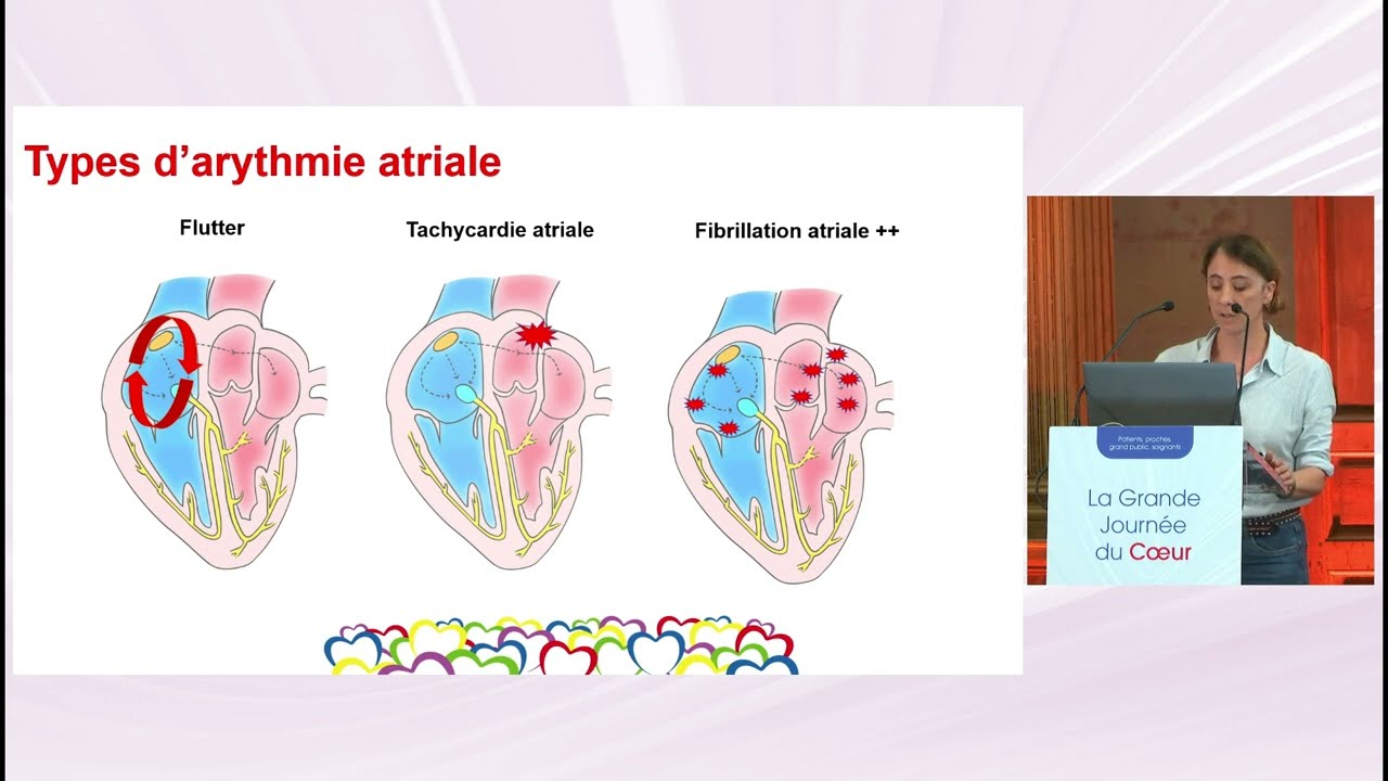 Grande Journée du Cœur 2025 - 09. La vulnérabilité rythmologique