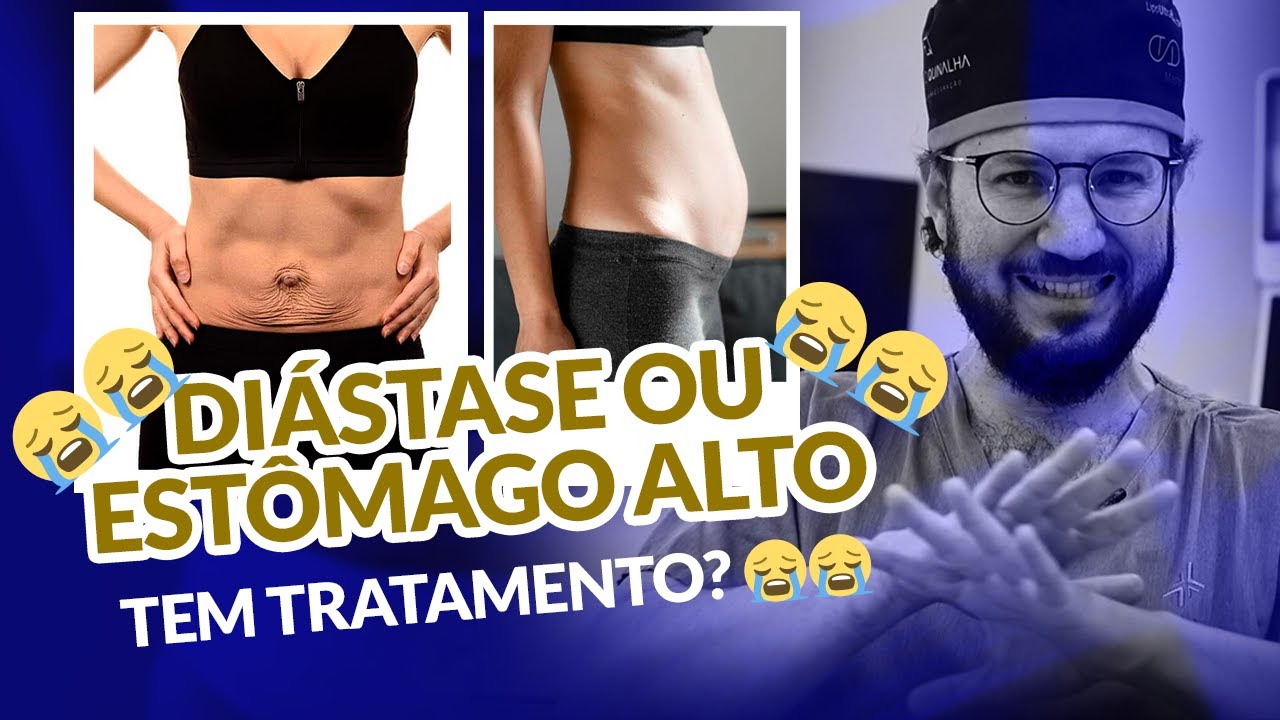 DIÁSTASE OU ESTÔMAGO ALTO, TEM TRATAMENTO? O QUE FAZER?