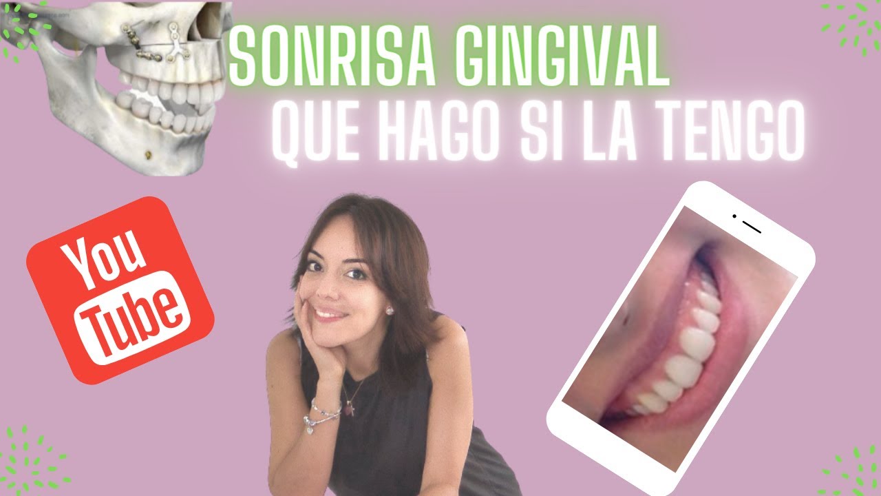 MUESTRAS MUCHA ENCÍA AL SONREÍR?? TE DIGO CÓMO MEJORAR