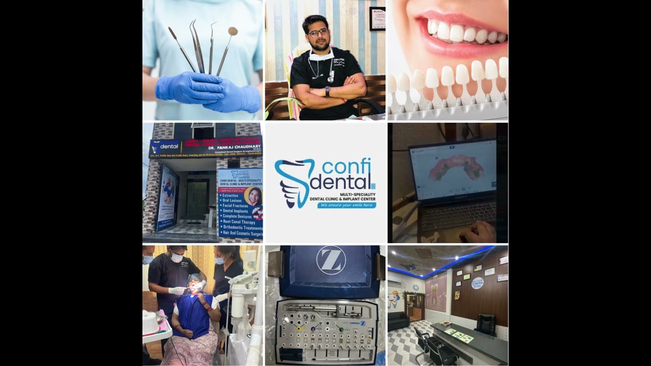 🦷 Confidental Multi-Speciality Dental Clinic & Implant Center, Mathura 🦷