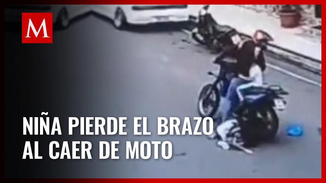 Menor sufre grave accidente en motocicleta en Ecuador: pierde su brazo