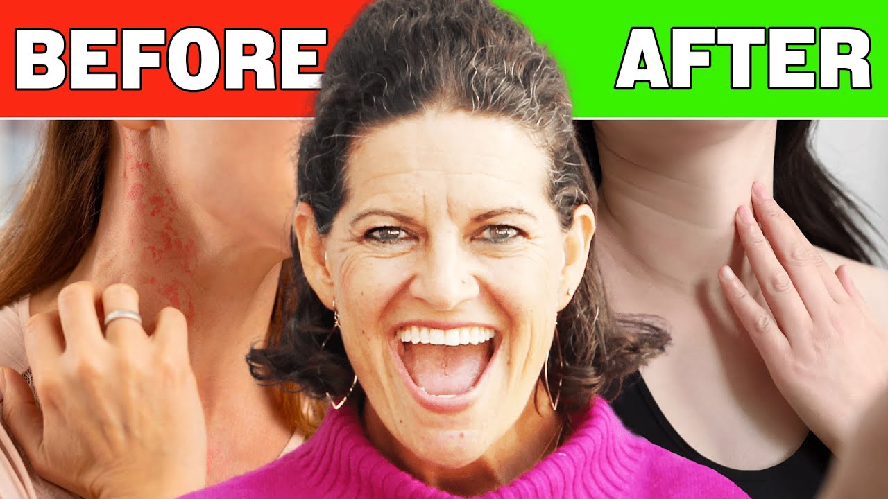 When I Quit Sugar, This Is How My Body Changed! | Dr. Mindy Pelz
