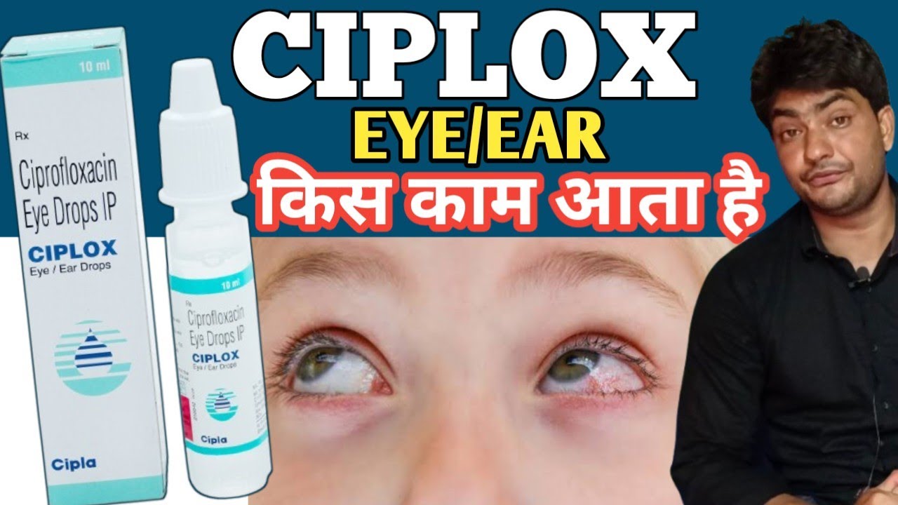 ciplox eye drops | ciplox eye ear drops | ciplox eye drops uses in hindi | ciplox eye drops baby
