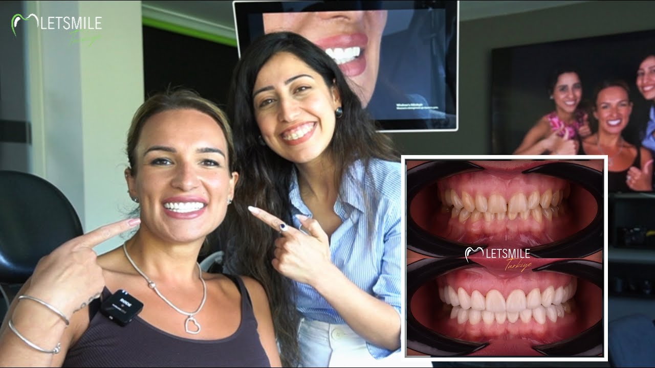 ANTALYA DENTAL TREATMENT | ANTALYA DENTAL CLINIC | LET SMILE TURKIYE | LETSMILE TURKIYE | LETSSMILE