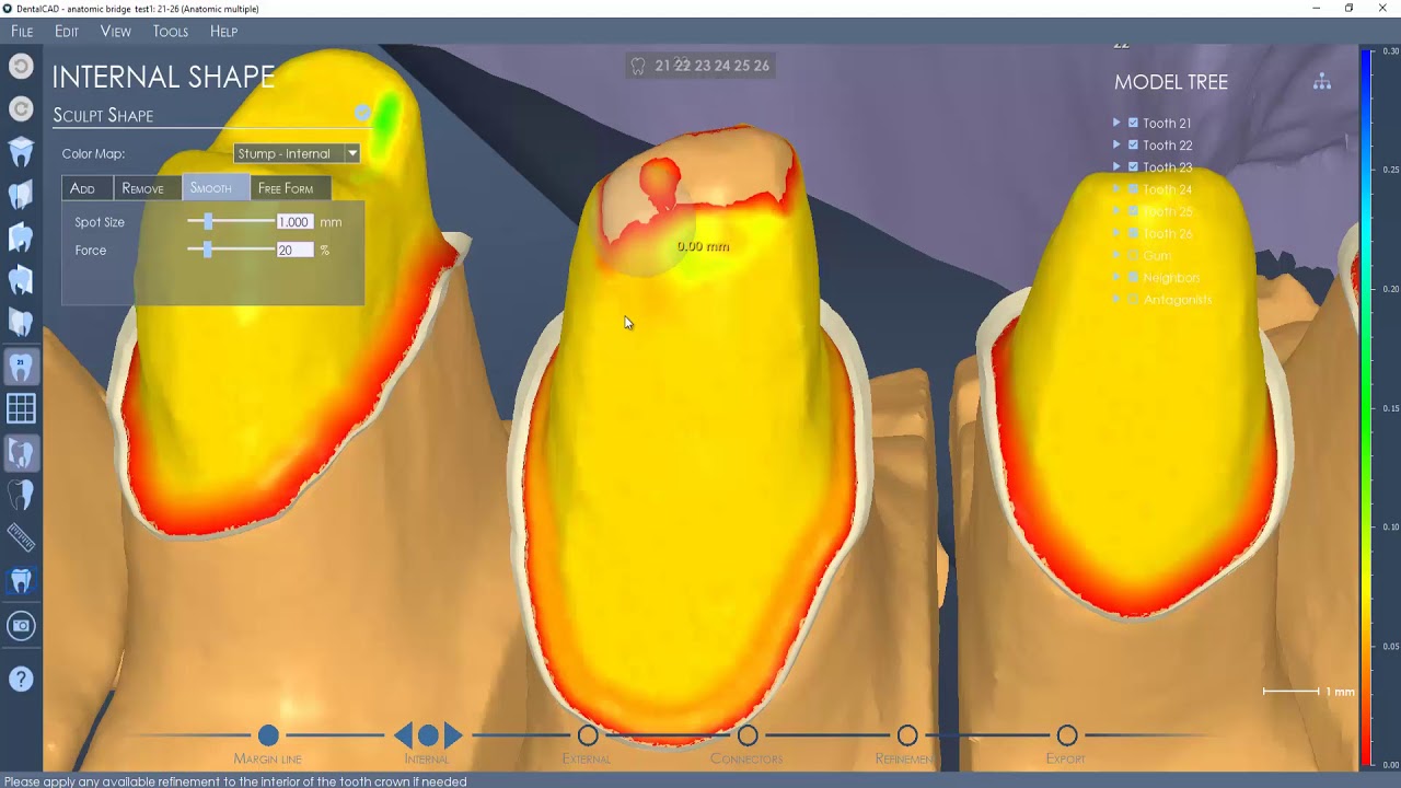 DentalCad 6.4 - Anatomic Bridge tutorial