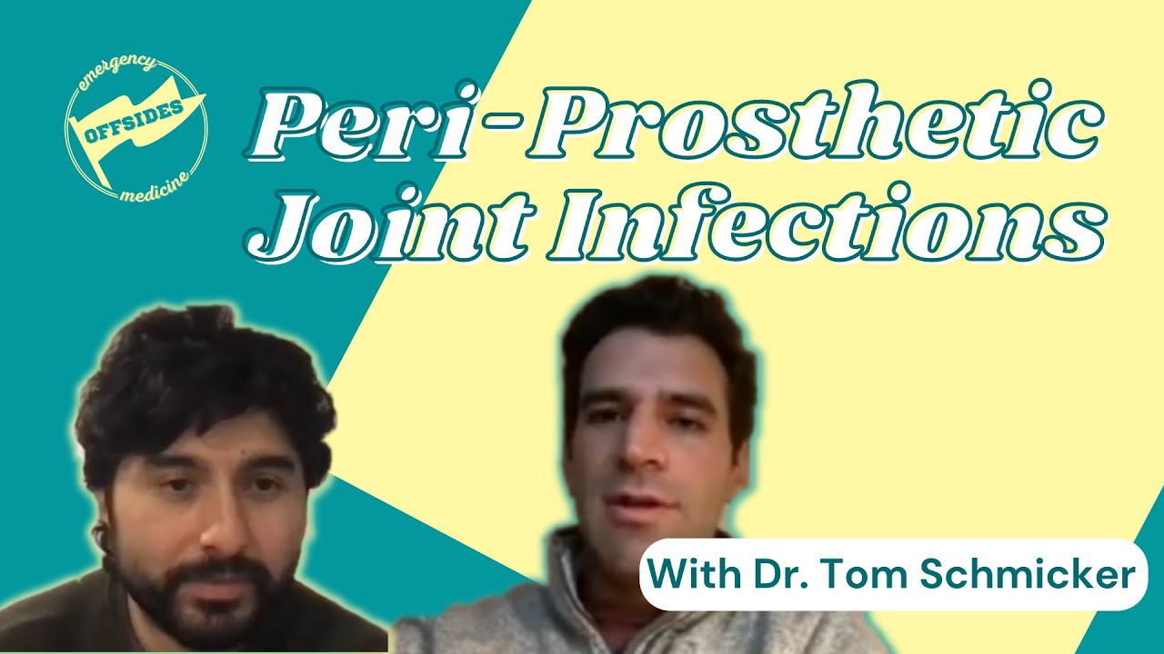 Peri-Prosthetic Joint Infections