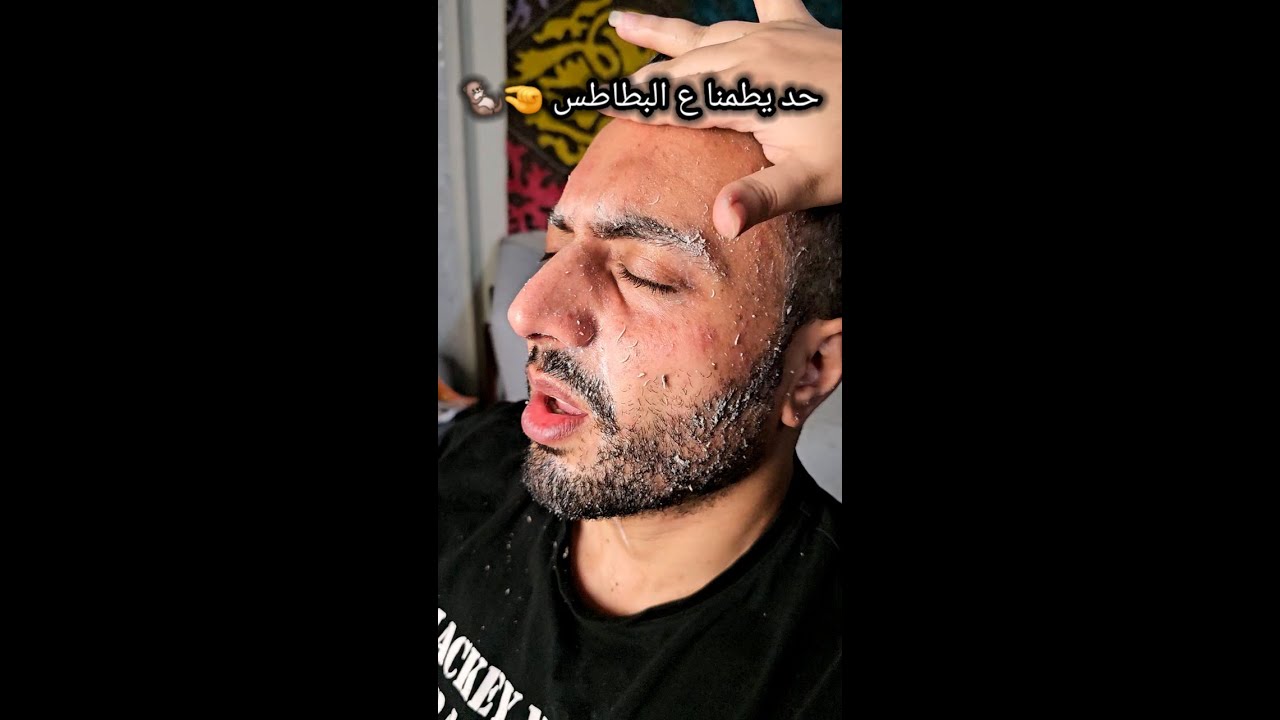حد يطمنا ع البطاطس 🤏🦦😭😭  #شروق_واسلاوو #اسلاوو#skincare #viralvideo #funny #foryou #fypシ゚