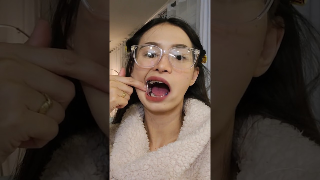 Why Is Her Mouth Is FULL Of METAL!? 😳🦷