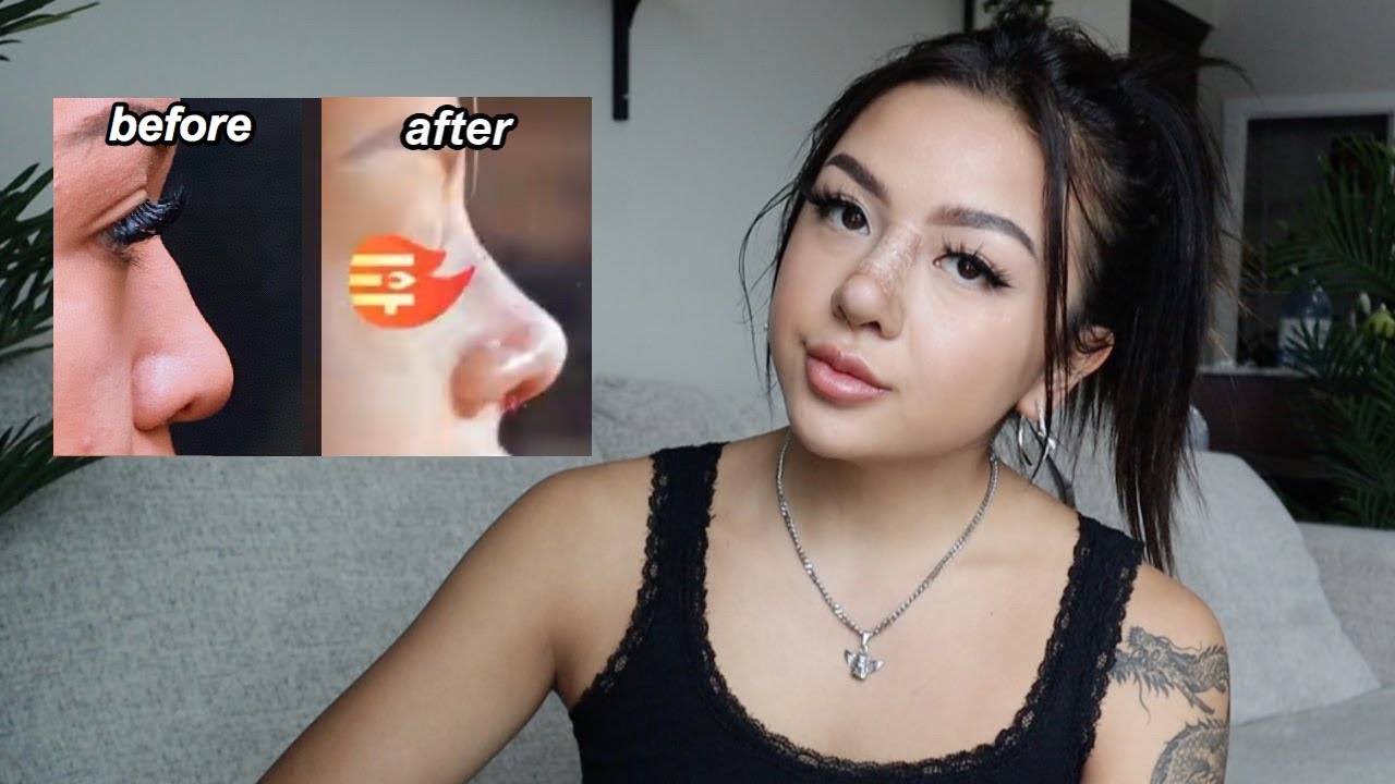 why I got a nose job at 17...