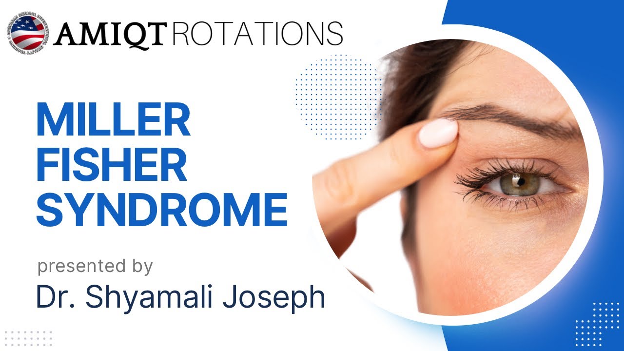 Miller Fisher Syndrome  by Dr. Shyamali Joseph