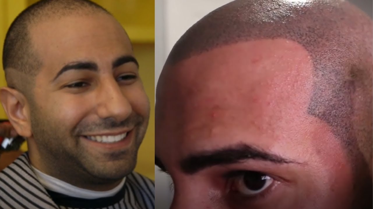 THE WORST SMP (SCALP MICROPIGMENTATION) RESULT EVER FOR TREATING HAIR LOSS! *FT. FOUSEYTUBE!*