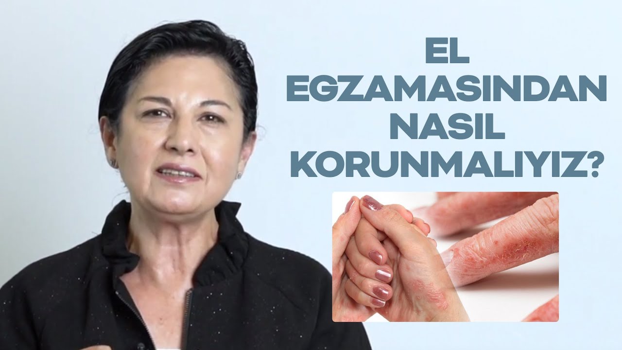 El Egzemasından Nasıl Korunmalıyız? | Topicrem | Cilt ve Bakım #elegzaması