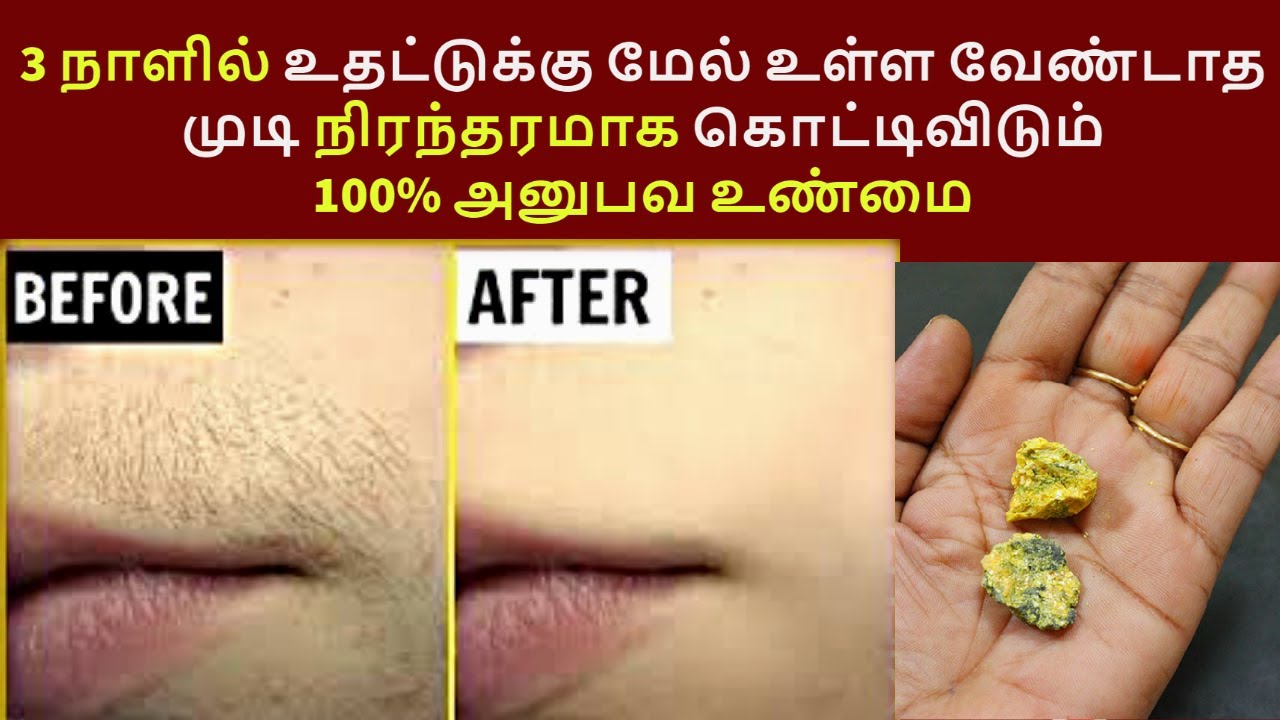 நிரந்தரமாக வேண்டாத முடிகள் கொட்டிவிடும் Permanent unwanted upperlip underarm hair removal homeremedy