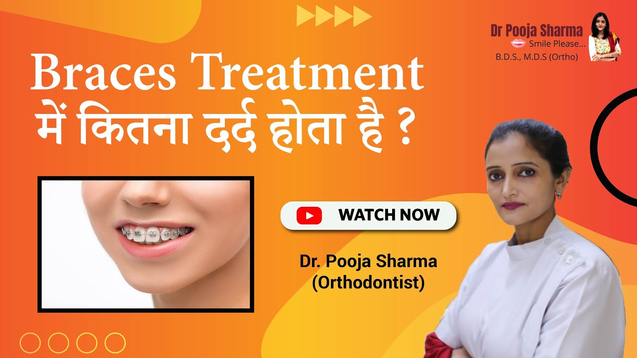 Is Braces Treatment Extremely Painful? Best Braces Treatment in Agra, India - Dr. Pooja Sharma