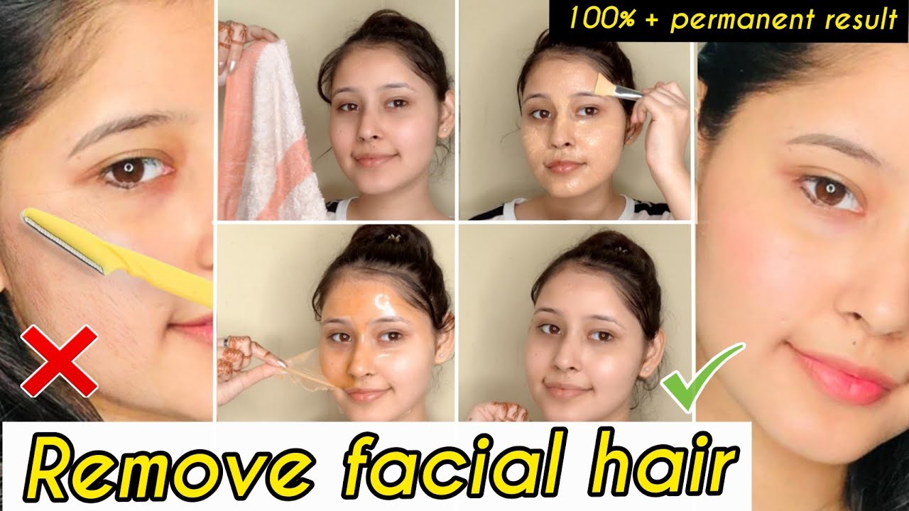 *New* Remove Facial Hair at Home💕Pemanently|How i Clear my face in 2 weeks |Kiran Tutorialz