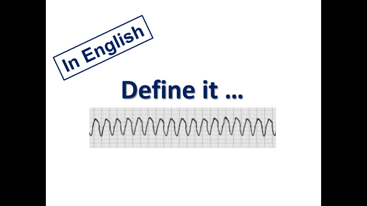 ESC Guidelines: 1. Definitions of VAs & SCD (English Version)