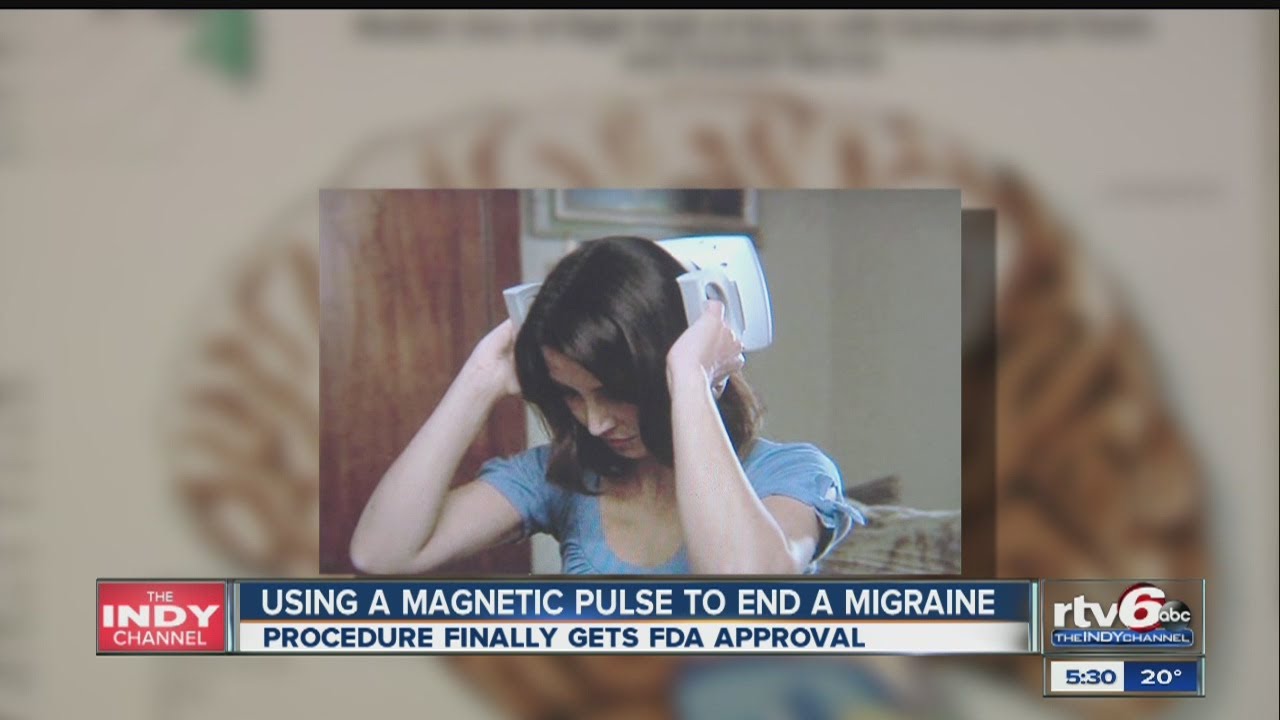 Magnet therapy gives new hope to migraine sufferers